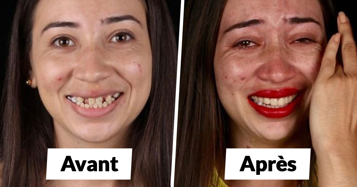 Ce dentiste voyage pour soigner gratuitement les dents des pauvres et voici 22 transformations étonnantes
