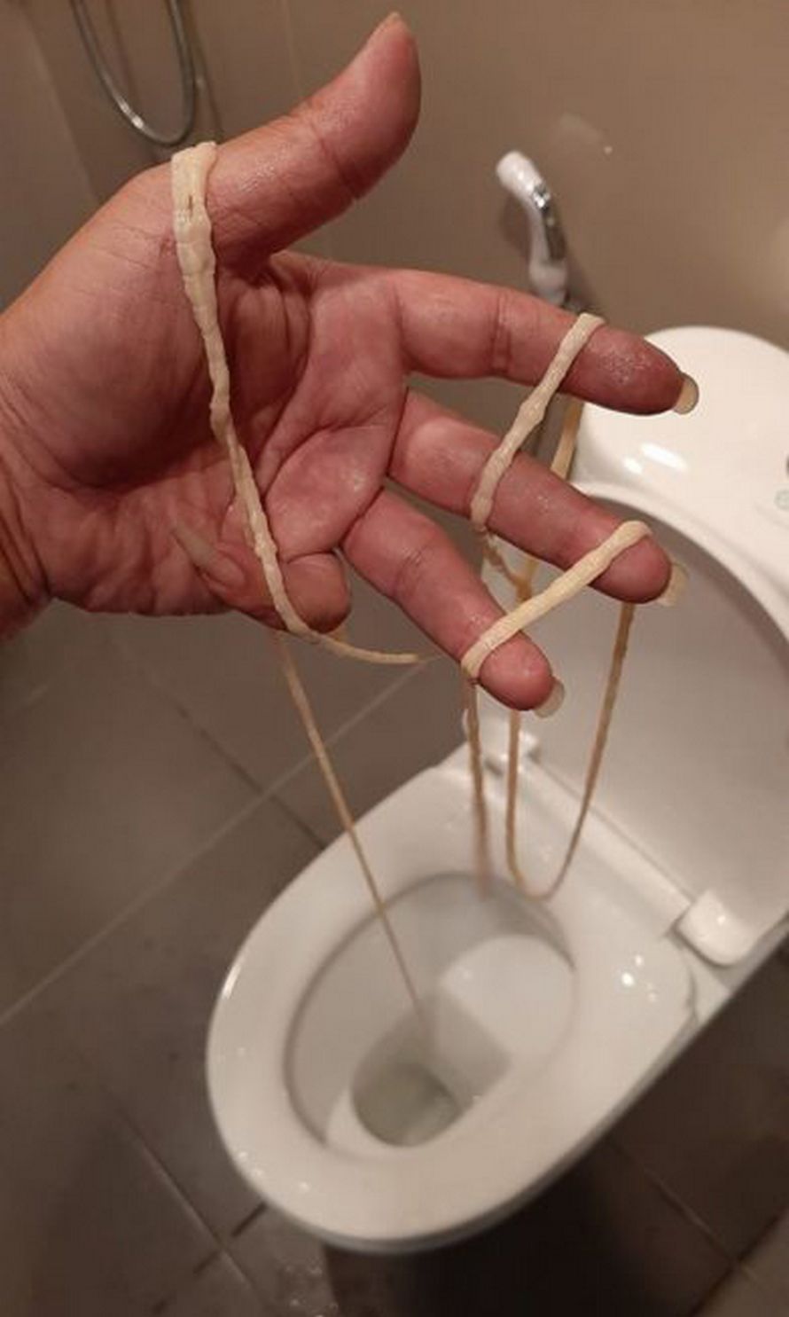 Un homme a été horrifié après avoir retiré de ses fesses un immense ver solitaire vivant