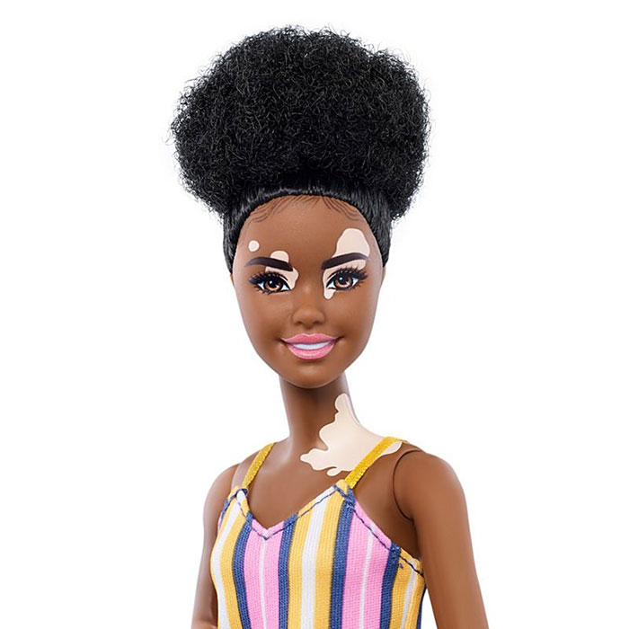 Barbie célèbre la diversité en créant des poupées aux capacités différentes avec du vitiligo et sans cheveux qui viennent en 35 tons de peau différents