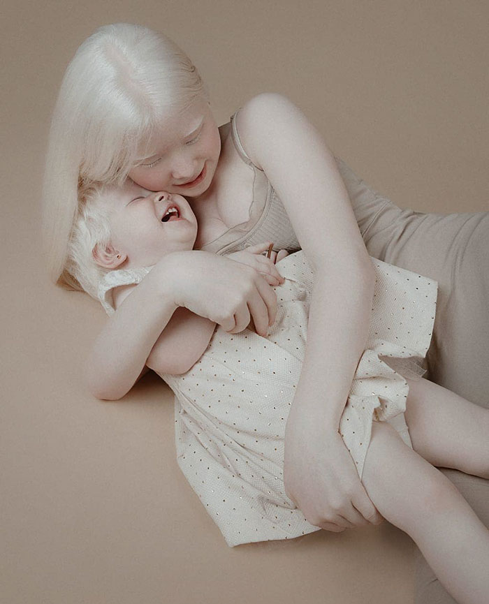 Ces soeurs albinos nées à 12 ans d’intervalle ont stupéfié la planète entière par leur beauté extraordinaire (24 images)