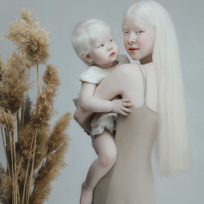 Ces soeurs albinos nées à 12 ans d’intervalle ont stupéfié la planète entière par leur beauté extraordinaire (24 images)
