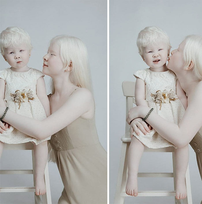 Ces soeurs albinos nées à 12 ans d’intervalle ont stupéfié la planète entière par leur beauté extraordinaire (24 images)