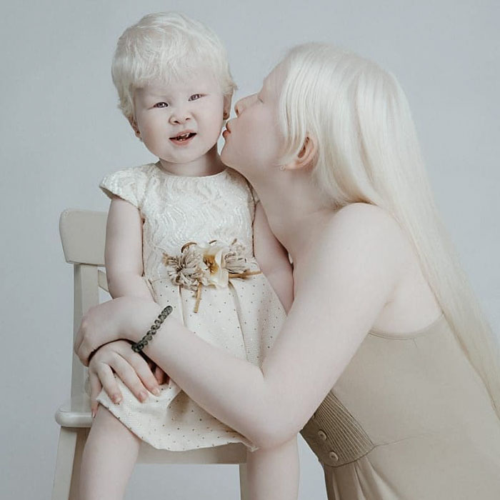 Ces soeurs albinos nées à 12 ans d’intervalle ont stupéfié la planète entière par leur beauté extraordinaire (24 images)