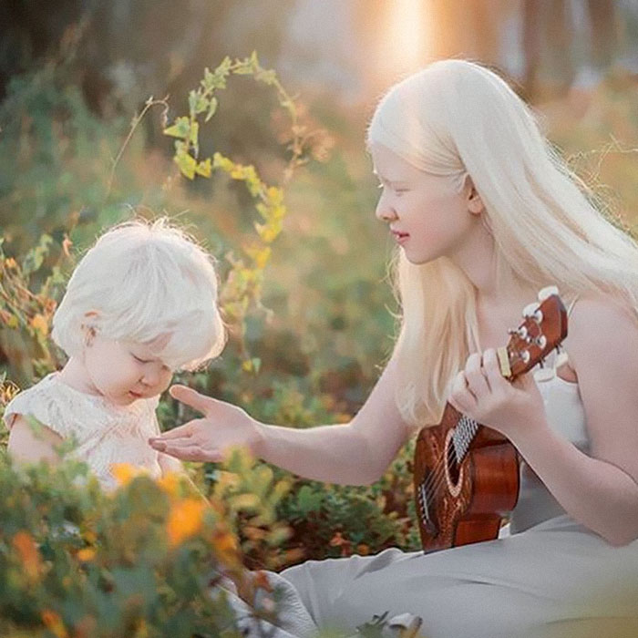 Ces soeurs albinos nées à 12 ans d’intervalle ont stupéfié la planète entière par leur beauté extraordinaire (24 images)