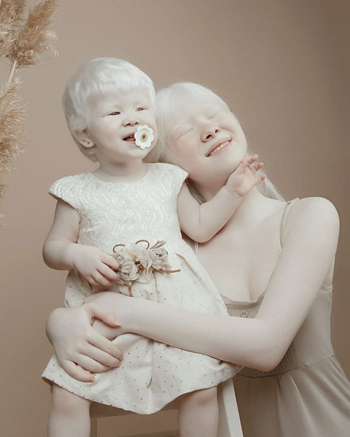Ces soeurs albinos nées à 12 ans d’intervalle ont stupéfié la planète entière par leur beauté extraordinaire (24 images)