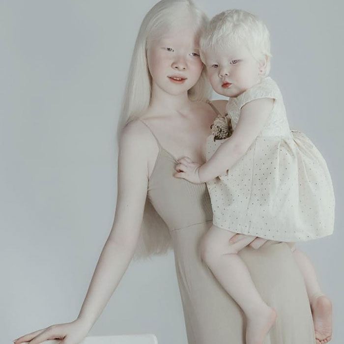 Ces soeurs albinos nées à 12 ans d’intervalle ont stupéfié la planète entière par leur beauté extraordinaire (24 images)