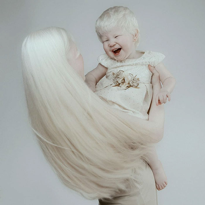 Ces soeurs albinos nées à 12 ans d’intervalle ont stupéfié la planète entière par leur beauté extraordinaire (24 images)