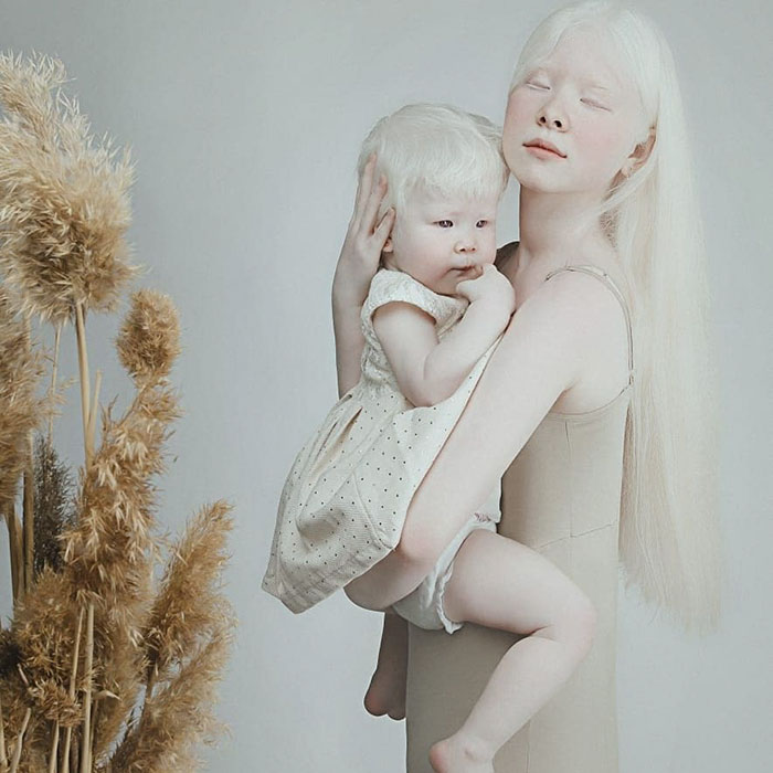 Ces soeurs albinos nées à 12 ans d’intervalle ont stupéfié la planète entière par leur beauté extraordinaire (24 images)