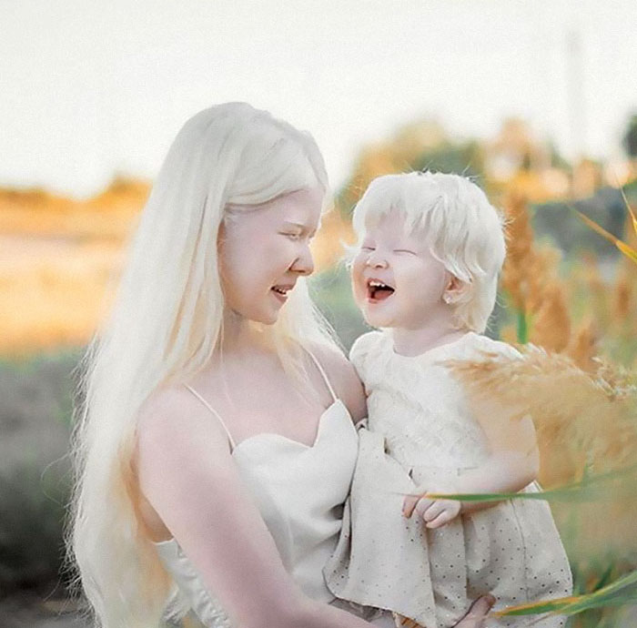 Ces soeurs albinos nées à 12 ans d’intervalle ont stupéfié la planète entière par leur beauté extraordinaire (24 images)