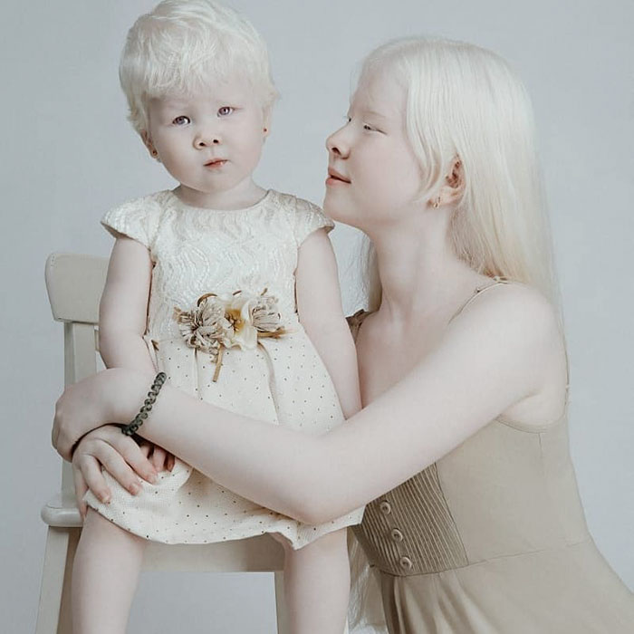 Ces soeurs albinos nées à 12 ans d’intervalle ont stupéfié la planète entière par leur beauté extraordinaire (24 images)