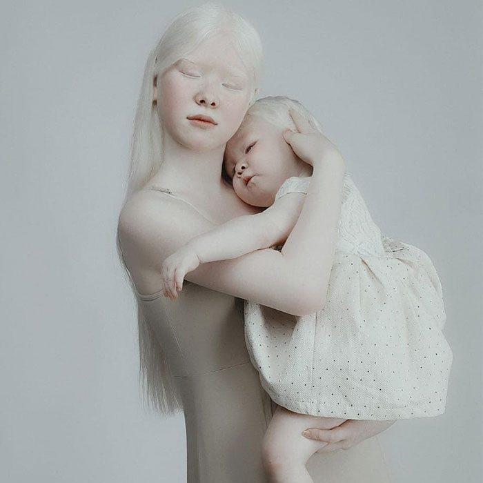 Ces soeurs albinos nées à 12 ans d’intervalle ont stupéfié la planète entière par leur beauté extraordinaire (24 images)