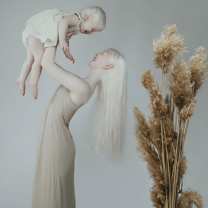 Ces soeurs albinos nées à 12 ans d’intervalle ont stupéfié la planète entière par leur beauté extraordinaire (24 images)