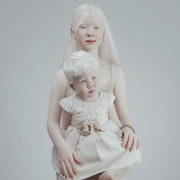 Ces soeurs albinos nées à 12 ans d’intervalle ont stupéfié la planète entière par leur beauté extraordinaire (24 images)