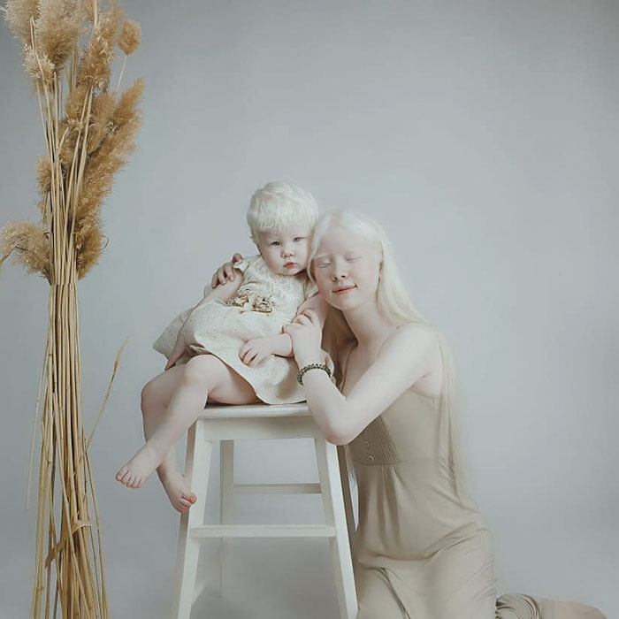 Ces soeurs albinos nées à 12 ans d’intervalle ont stupéfié la planète entière par leur beauté extraordinaire (24 images)