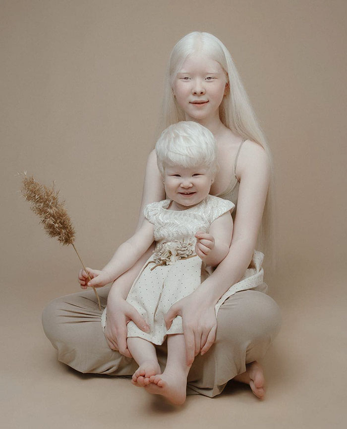 Ces soeurs albinos nées à 12 ans d’intervalle ont stupéfié la planète entière par leur beauté extraordinaire (24 images)