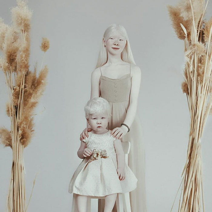 Ces soeurs albinos nées à 12 ans d’intervalle ont stupéfié la planète entière par leur beauté extraordinaire (24 images)