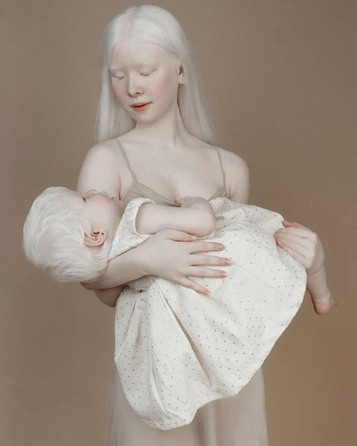 Ces soeurs albinos nées à 12 ans d’intervalle ont stupéfié la planète entière par leur beauté extraordinaire (24 images)