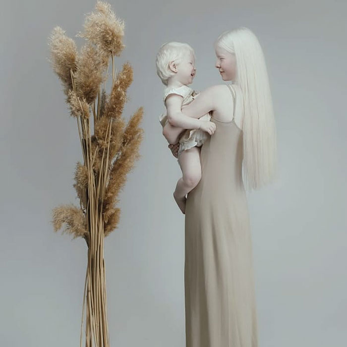 Ces soeurs albinos nées à 12 ans d’intervalle ont stupéfié la planète entière par leur beauté extraordinaire (24 images)