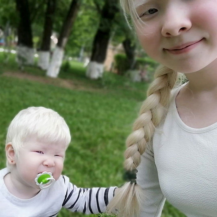 Ces soeurs albinos nées à 12 ans d’intervalle ont stupéfié la planète entière par leur beauté extraordinaire (24 images)