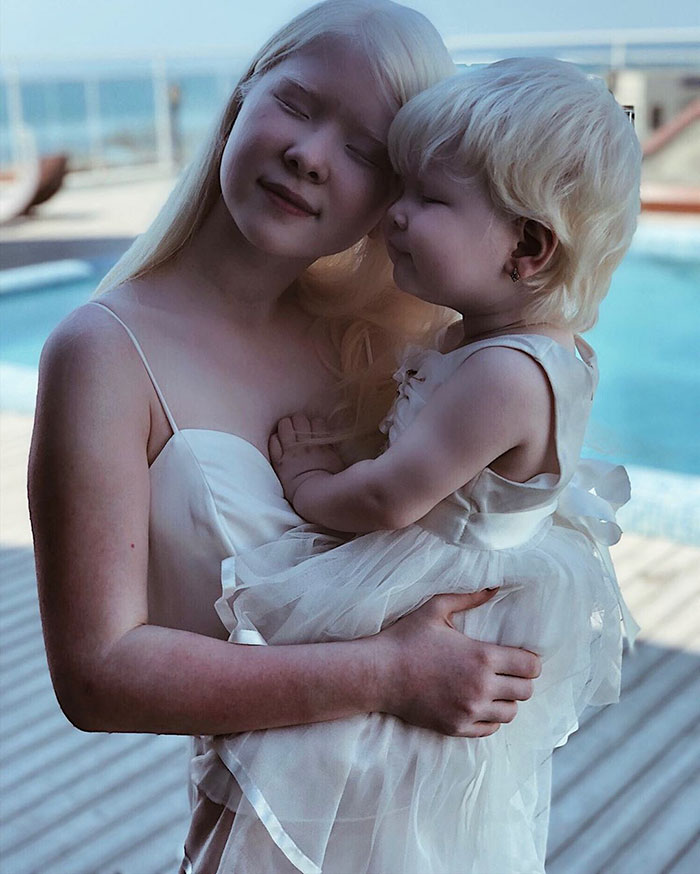 Ces soeurs albinos nées à 12 ans d’intervalle ont stupéfié la planète entière par leur beauté extraordinaire (24 images)