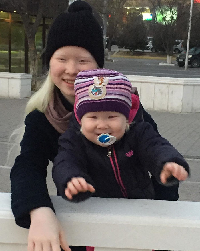 Ces soeurs albinos nées à 12 ans d’intervalle ont stupéfié la planète entière par leur beauté extraordinaire (24 images)