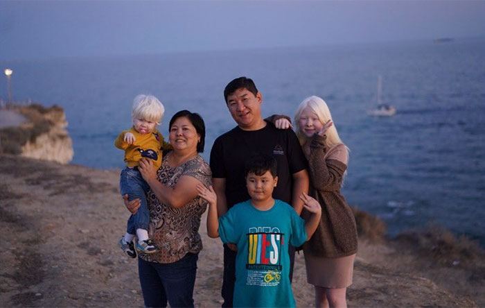 Ces soeurs albinos nées à 12 ans d’intervalle ont stupéfié la planète entière par leur beauté extraordinaire (24 images)