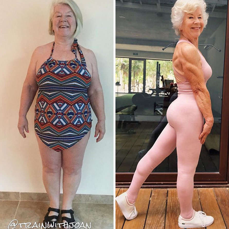 Une fille a aidé sa mère de 73 ans à perdre plus de 25 kilos et à retrouver la santé, et ses photos avant et après sont devenues virales