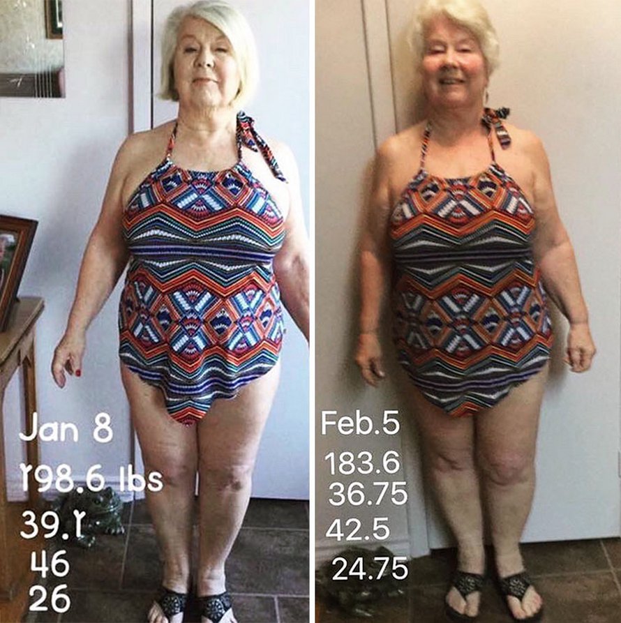 Une fille a aidé sa mère de 73 ans à perdre plus de 25 kilos et à retrouver la santé, et ses photos avant et après sont devenues virales