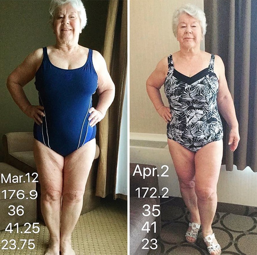 Une fille a aidé sa mère de 73 ans à perdre plus de 25 kilos et à retrouver la santé, et ses photos avant et après sont devenues virales