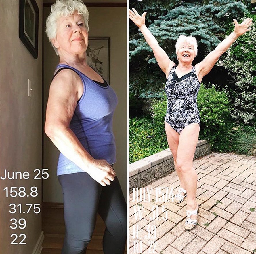 Une fille a aidé sa mère de 73 ans à perdre plus de 25 kilos et à retrouver la santé, et ses photos avant et après sont devenues virales