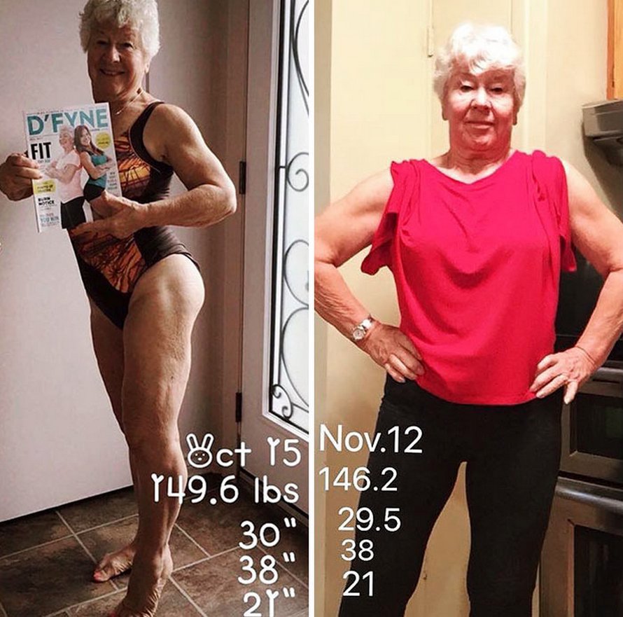 Une fille a aidé sa mère de 73 ans à perdre plus de 25 kilos et à retrouver la santé, et ses photos avant et après sont devenues virales