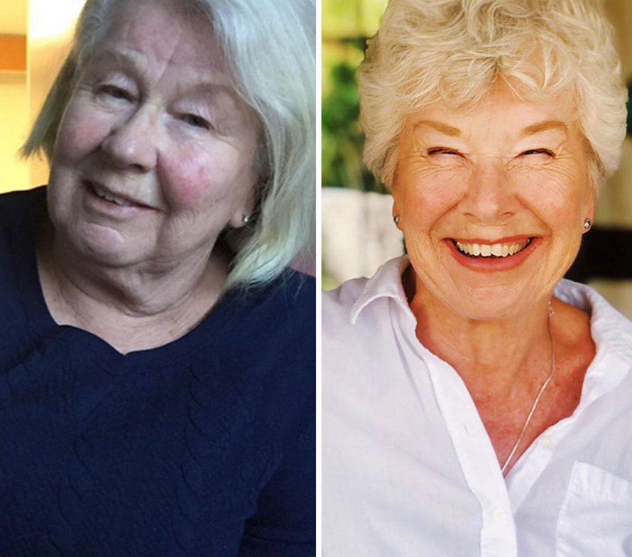 Une fille a aidé sa mère de 73 ans à perdre plus de 25 kilos et à retrouver la santé, et ses photos avant et après sont devenues virales