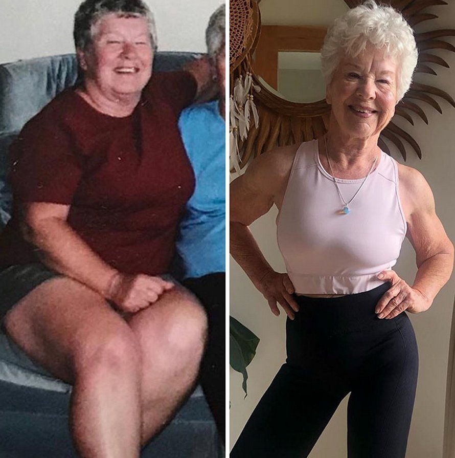 Une fille a aidé sa mère de 73 ans à perdre plus de 25 kilos et à retrouver la santé, et ses photos avant et après sont devenues virales