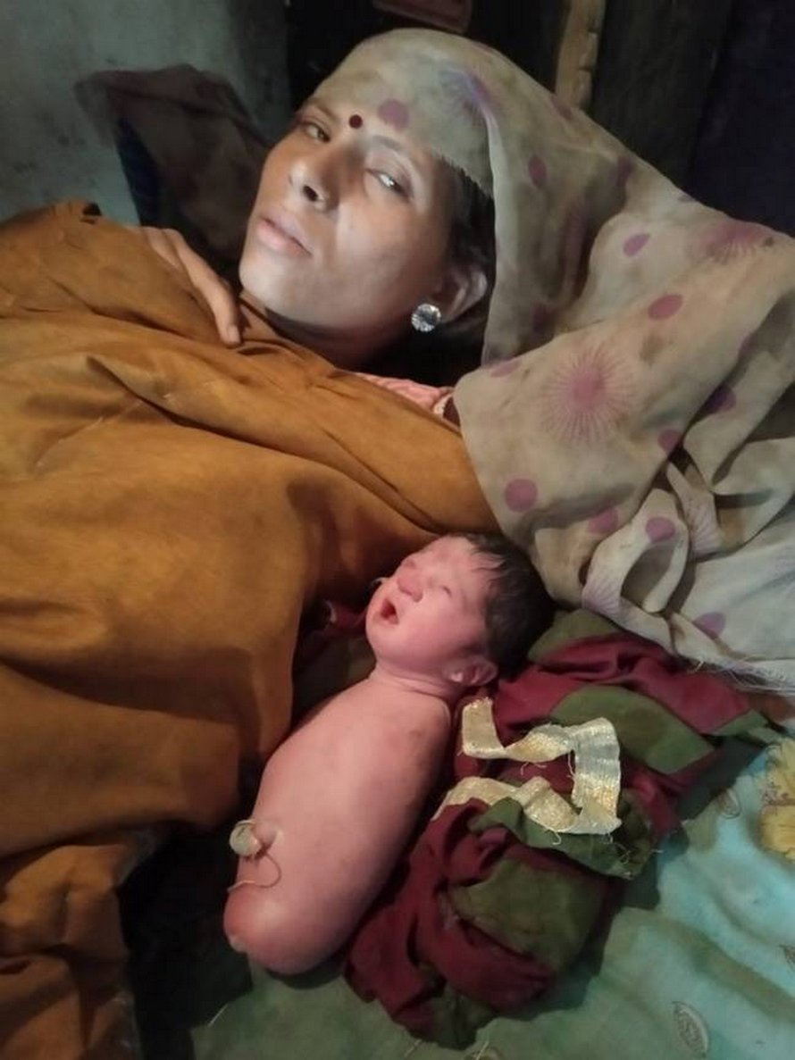 Un bébé est né sans bras ni jambes en Inde
