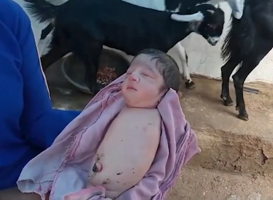 Un bébé est né sans bras ni jambes en Inde