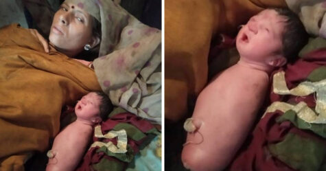 Un bébé est né sans bras ni jambes en Inde