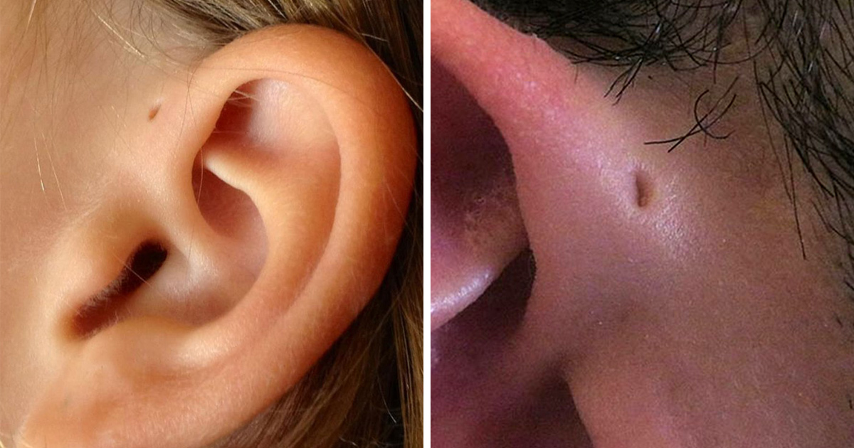 Les gens se rendent compte que ces petits trous au-dessus de leurs oreilles pourraient avoir une explication évolutive