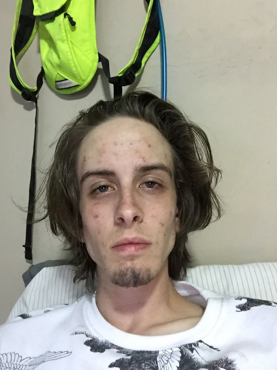 Un homme partage des photos avant et 745 jours après avoir arrêté la drogue et sa transformation est spectaculaire
