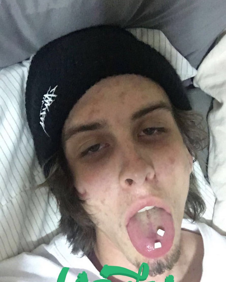 Un homme partage des photos avant et 745 jours après avoir arrêté la drogue et sa transformation est spectaculaire