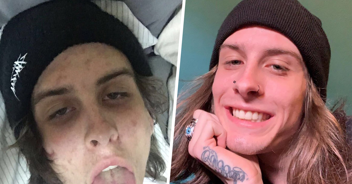 Un homme partage des photos avant et 745 jours après avoir arrêté la drogue et sa transformation est spectaculaire