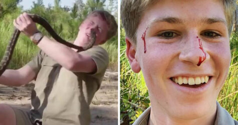 Robert Irwin présente une vidéo d&#8217;un serpent qui le mord au visage
