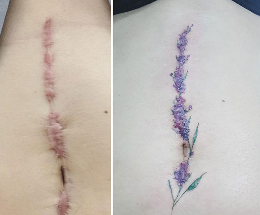 23 personnes qui ont demandé à cette artiste de recouvrir leurs cicatrices de tatouages