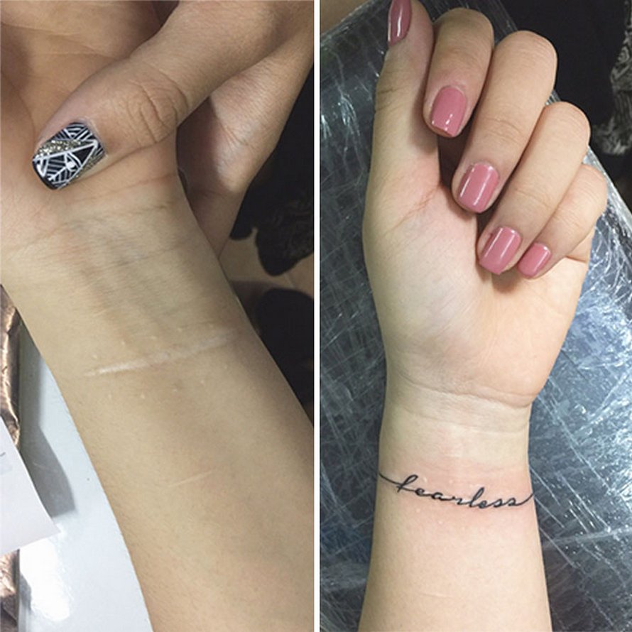 23 personnes qui ont demandé à cette artiste de recouvrir leurs cicatrices de tatouages ipnoze