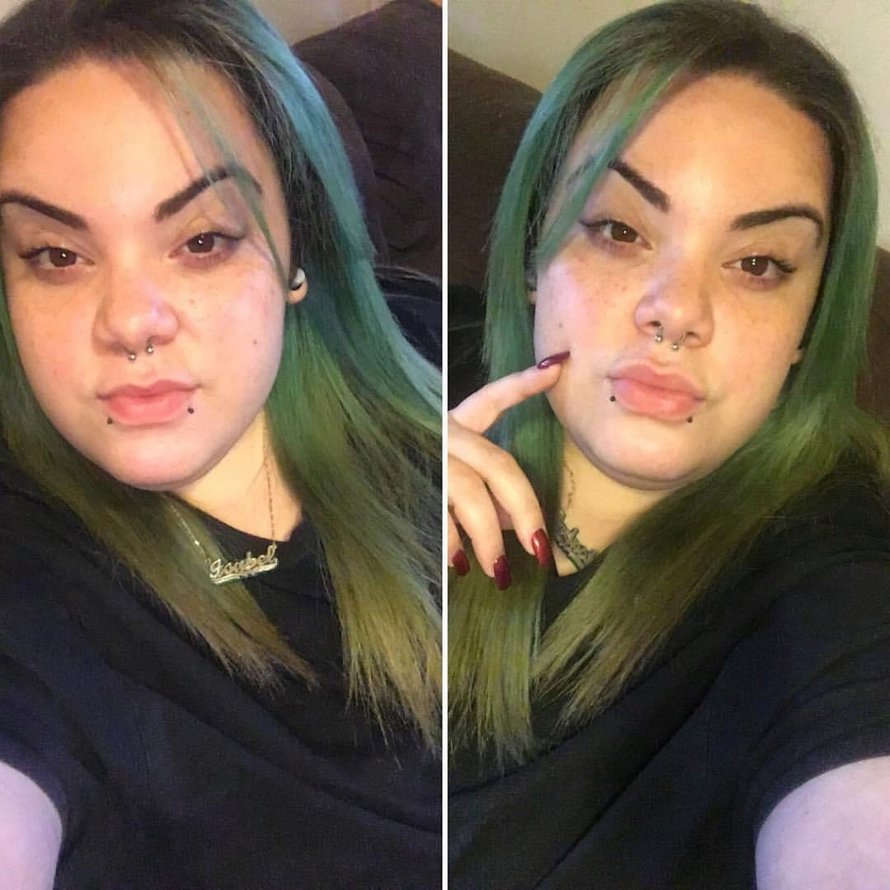 Cette femme ayant un excès de poils sur le visage causé par le SOPK se laisse pousser la barbe