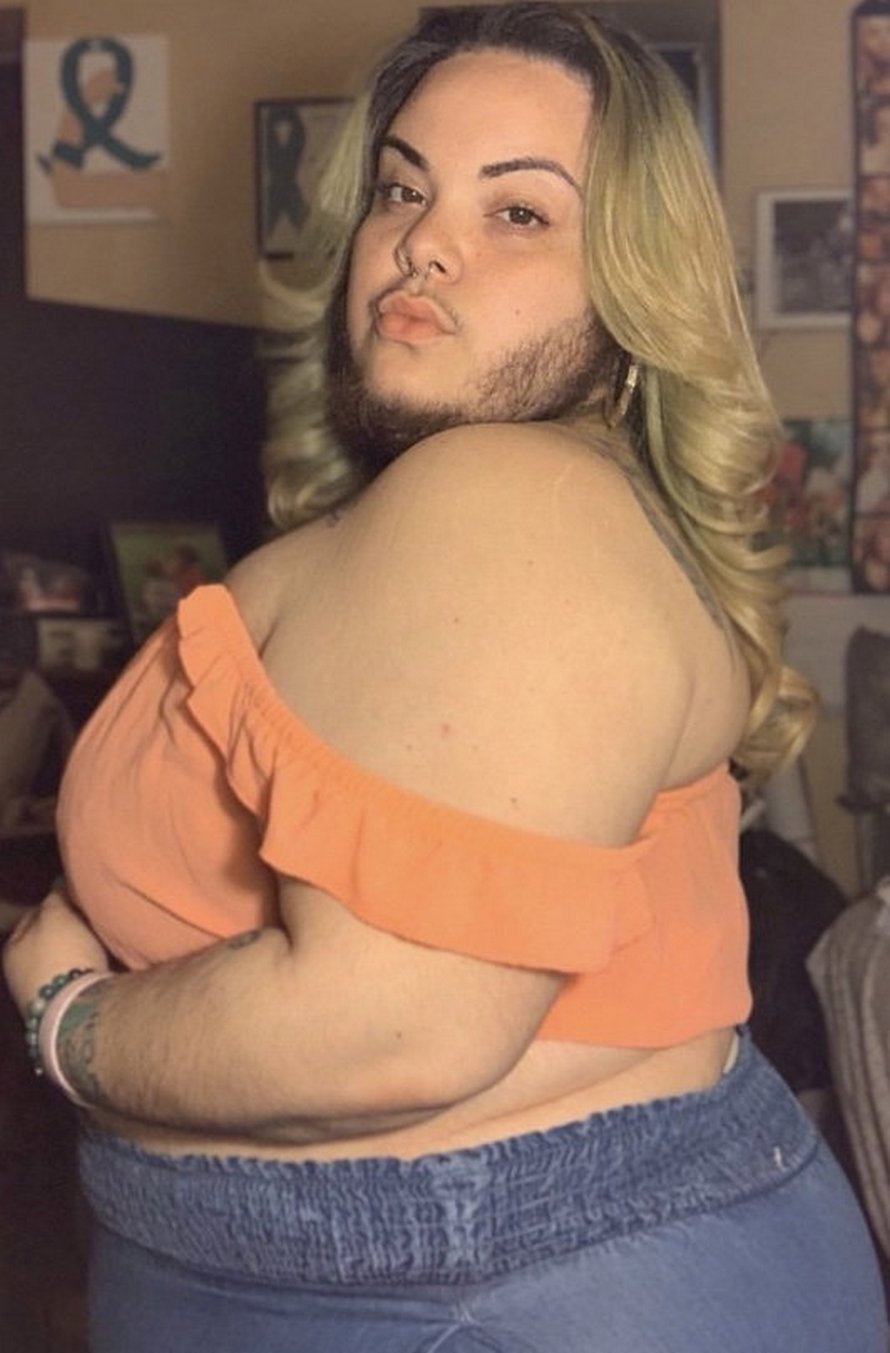 Cette femme ayant un excès de poils sur le visage causé par le SOPK se laisse pousser la barbe
