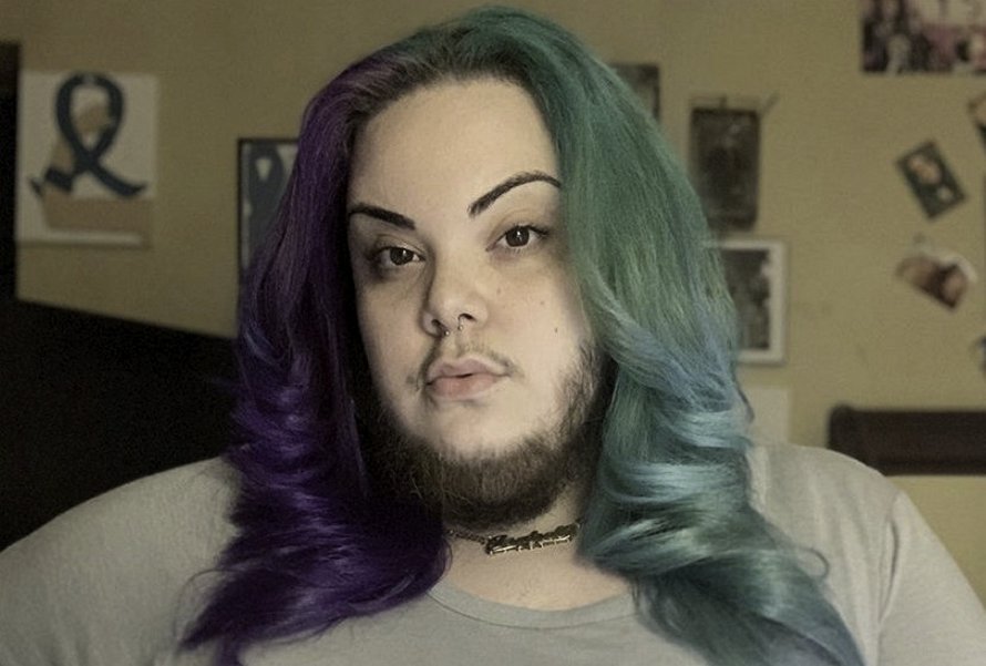 Cette femme ayant un excès de poils sur le visage causé par le SOPK se laisse pousser la barbe