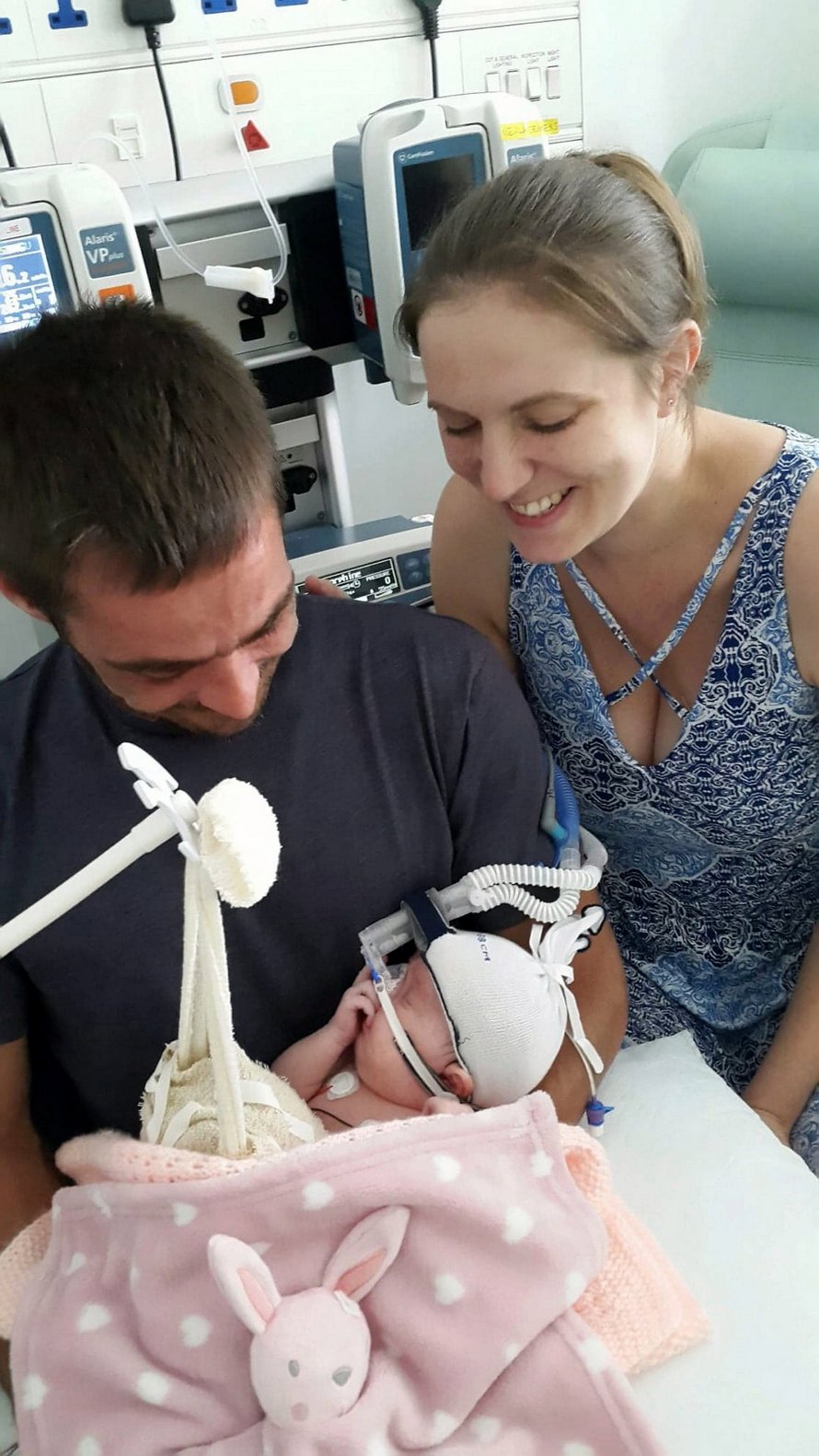 Cette petite fille est née avec les intestins, l’estomac et le foie à l’extérieur de son corps