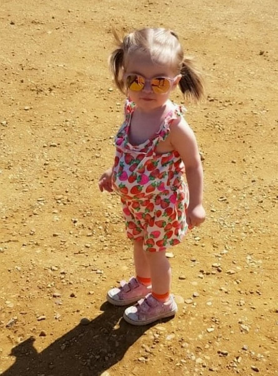 Cette petite fille est née avec les intestins, l’estomac et le foie à l’extérieur de son corps