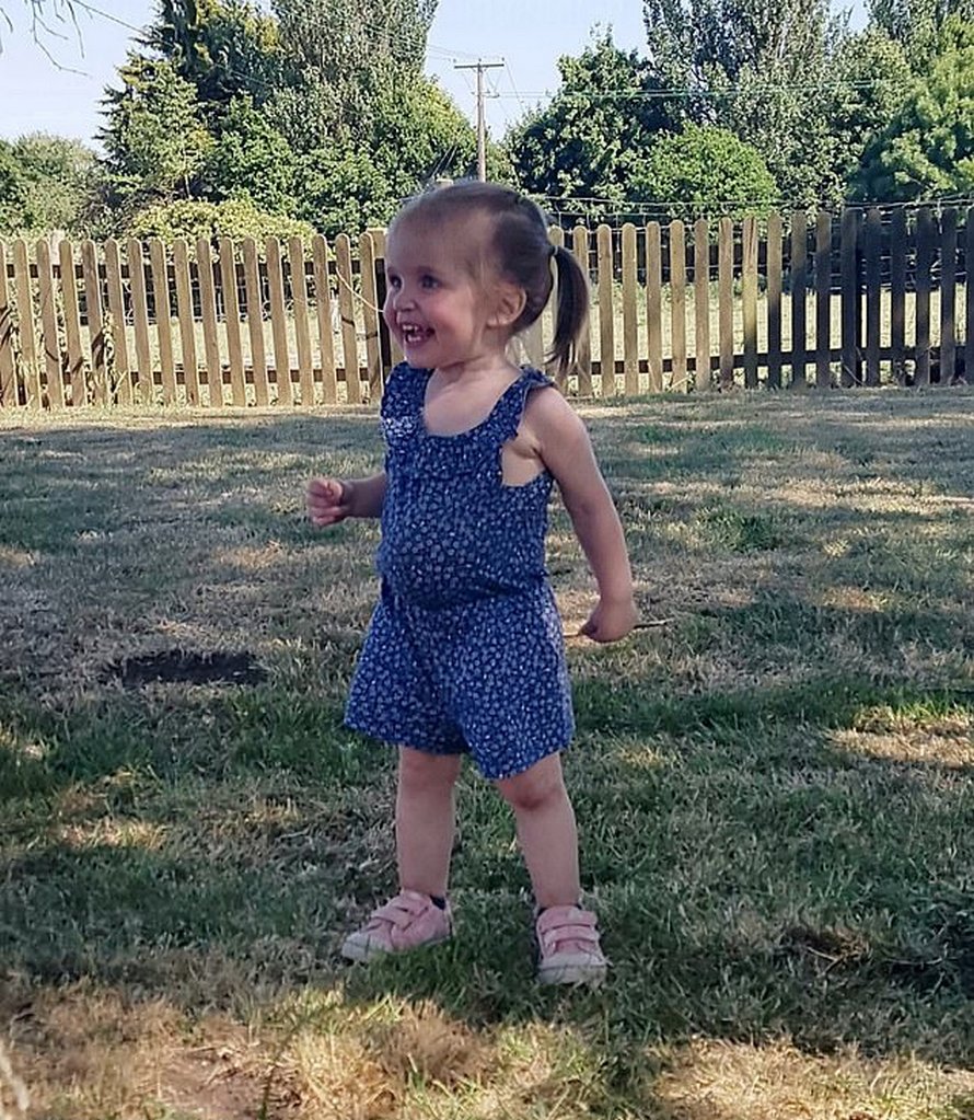 Cette petite fille est née avec les intestins, l’estomac et le foie à l’extérieur de son corps