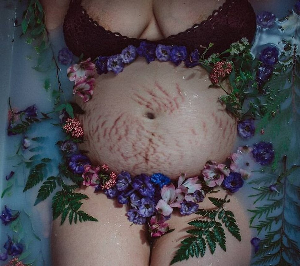 Des femmes partagent des photos brutes de leur corps post-partum qui montrent la réalité dont personne ne parle